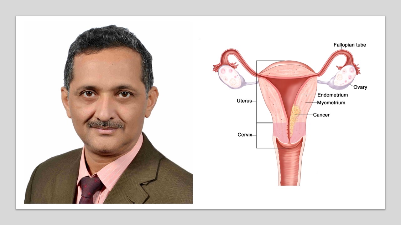 Uterine and cervical cancer in Ahmedabad